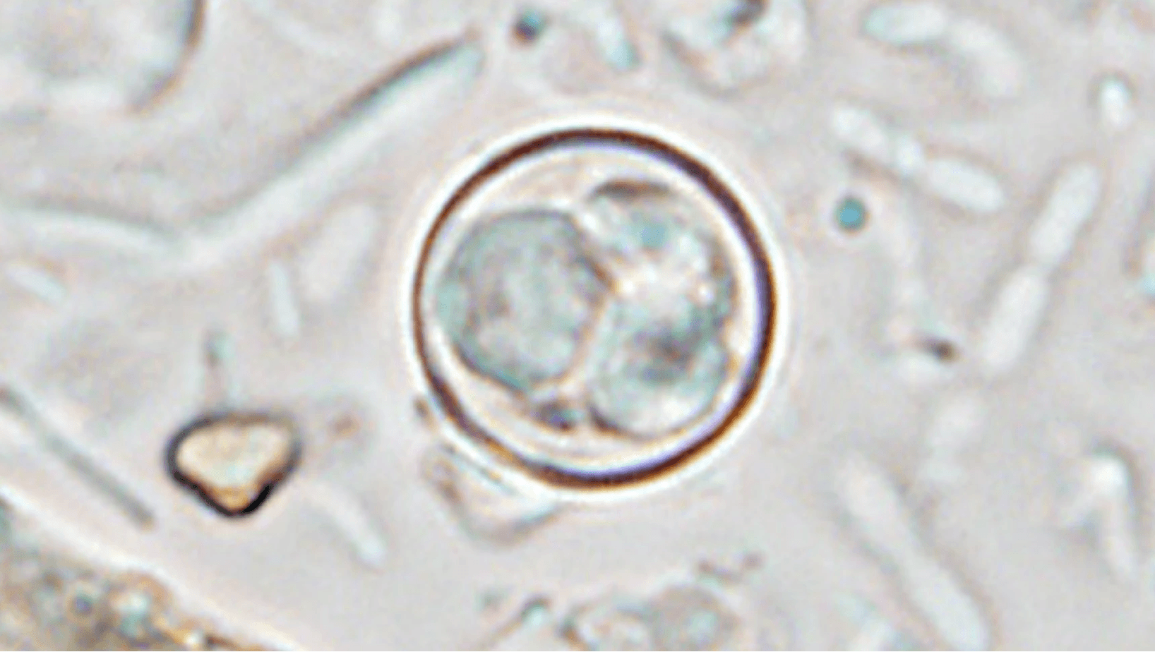 CDC reports more than 1,800 additional Cyclospora patients in past week